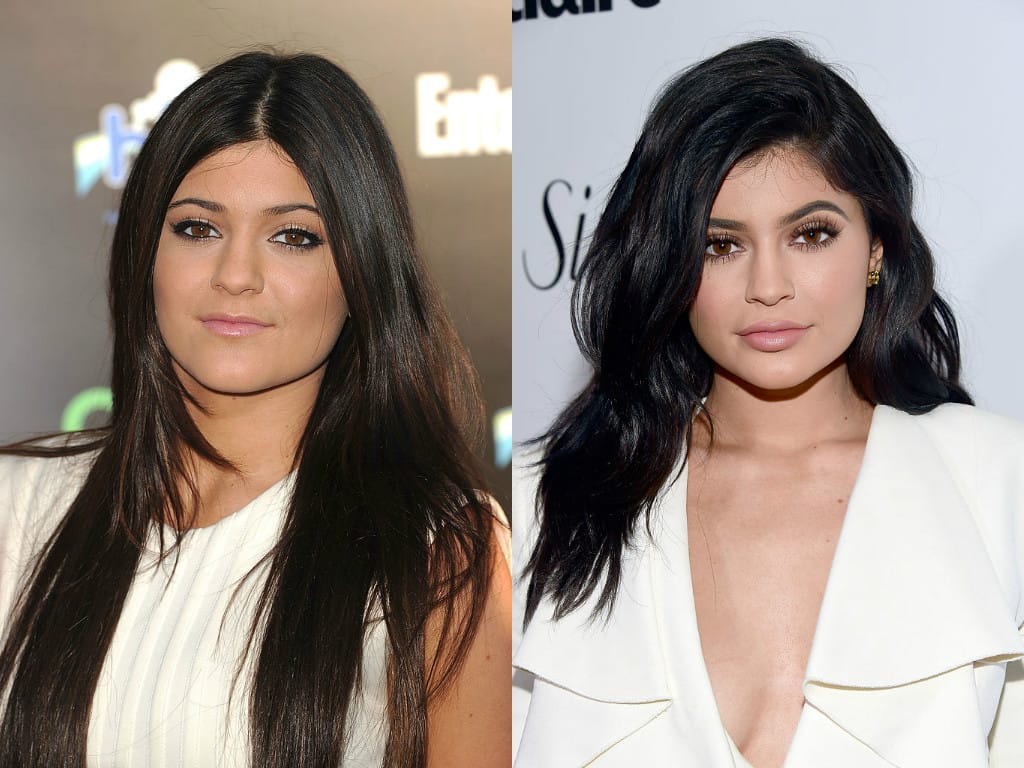 Kylie Jenner sieht heute komplett anders aus. Besonders auffällig sind ihre markanten Wangenknochen und ihr voluminöser Mund. © Getty Images Kylie Jenner